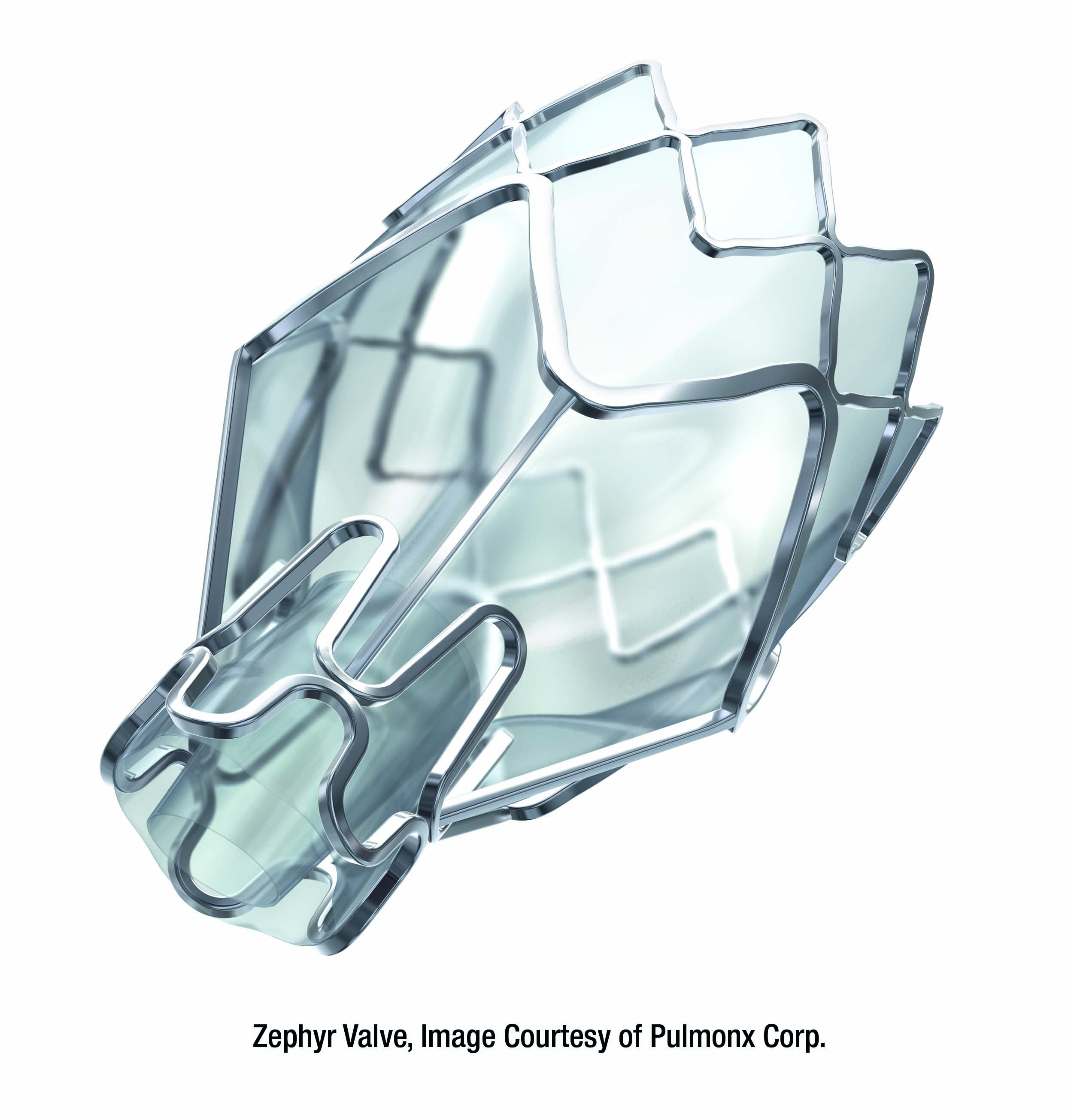 image of a valve