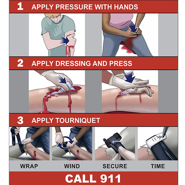 How to Stop the Bleed